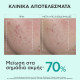 Apivita - Just Bee Clear Serum Azelaic Acid 10% Ορός με Αζελαϊκό Οξύ για Λείανση / Διόρθωση Ατελειών και Σημαδιών Ακμής - 30ml